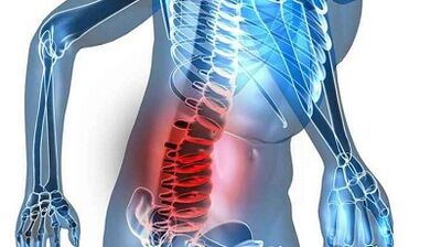 علامات وأعراض هشاشة العظم القطني